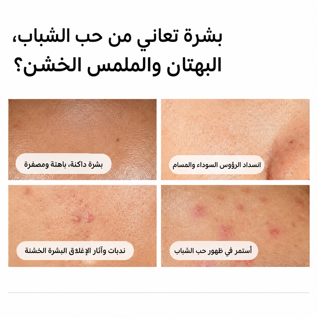 سيروم الهيالورونيك أسيد 2%+B5 ونياسيناميد 10%+زنك 30مل