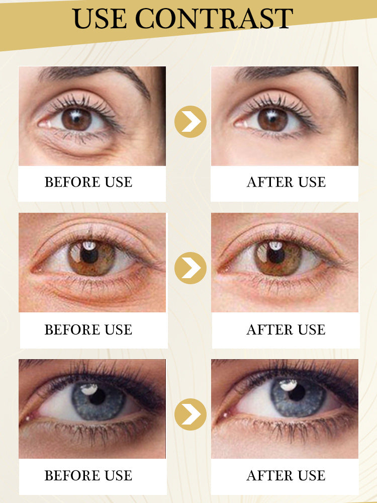 Dark Circle Remover Eye Cream Peptide Wrinkle Removal Serum Instant Eye Bags Anti-Puffiness Lifting Firming Skin Care Products