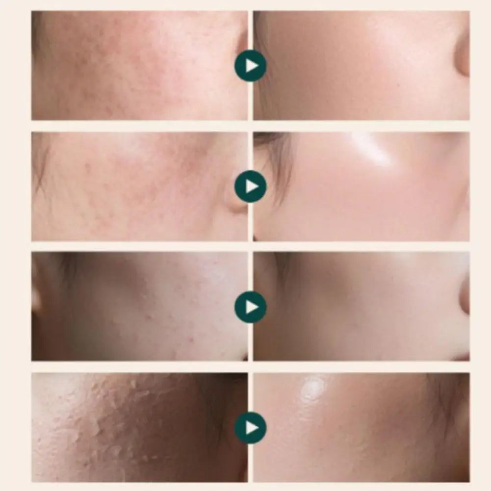 Advanced PDRN Rejuvenating Cream FOR SENSITIVE SKIN Wrinkle Remover Firming Lifting Nourishing Oil Control Korean Skin Care