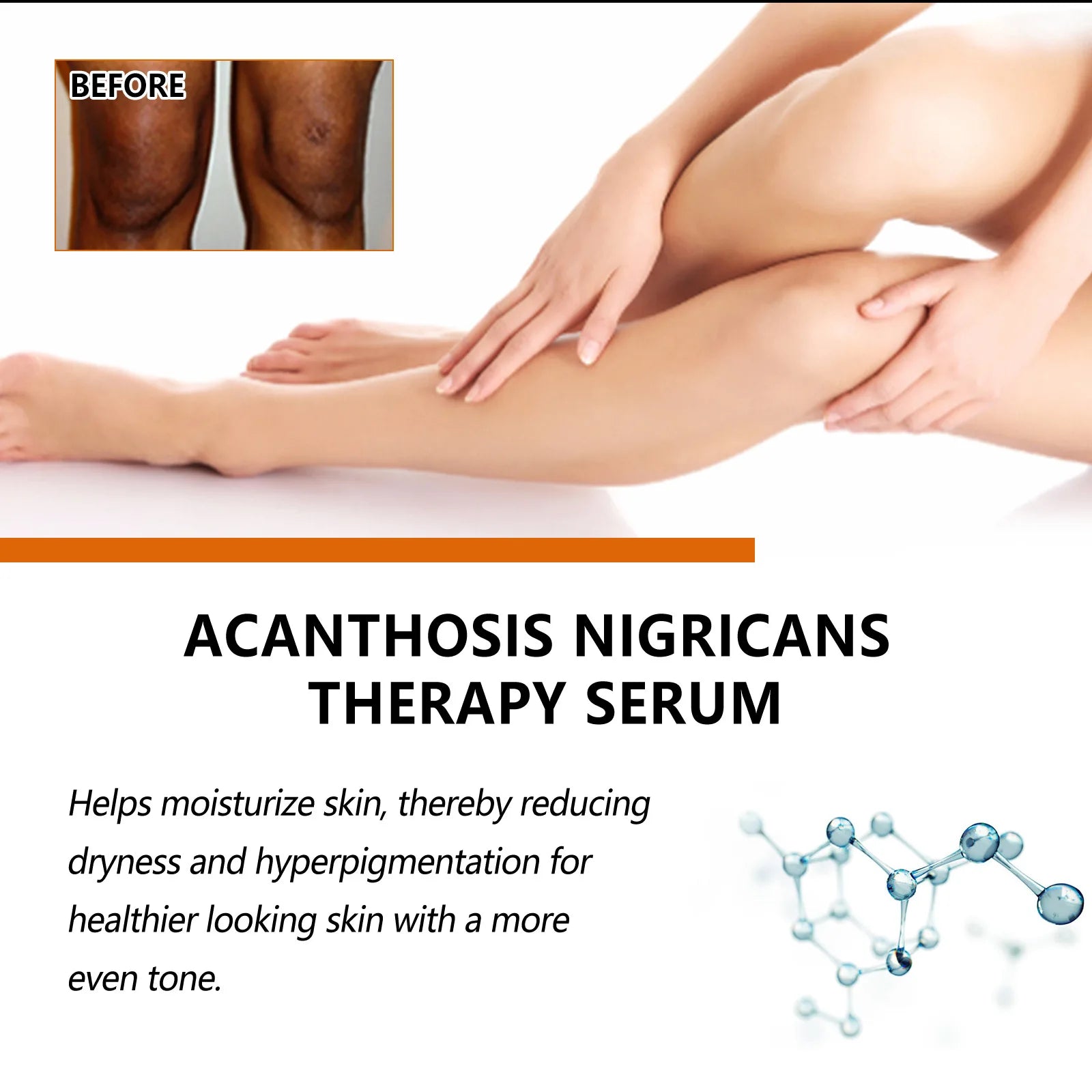 Dark Knuckles Whitening Serum Dark Knees Elbow Lightening Pigmentation Corrector Hand Knuckle Glow Intense Stains Remover Serum