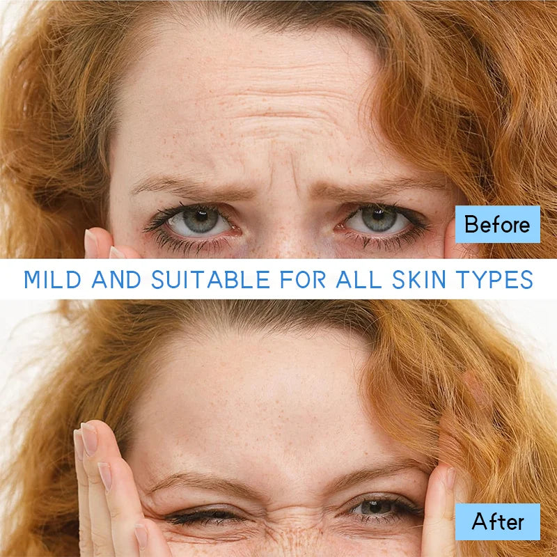 12Pcs Collagen Forehead Skin Care Patches Smoothing Fine Frown Lines Wrinkles Treatment High Quality Natural Material