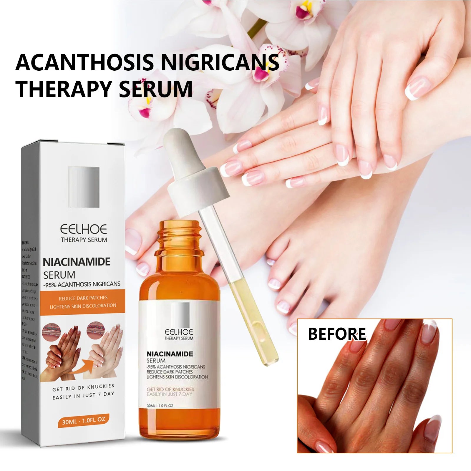 Dark Knuckles Whitening Serum Dark Knees Elbow Lightening Pigmentation Corrector Hand Knuckle Glow Intense Stains Remover Serum