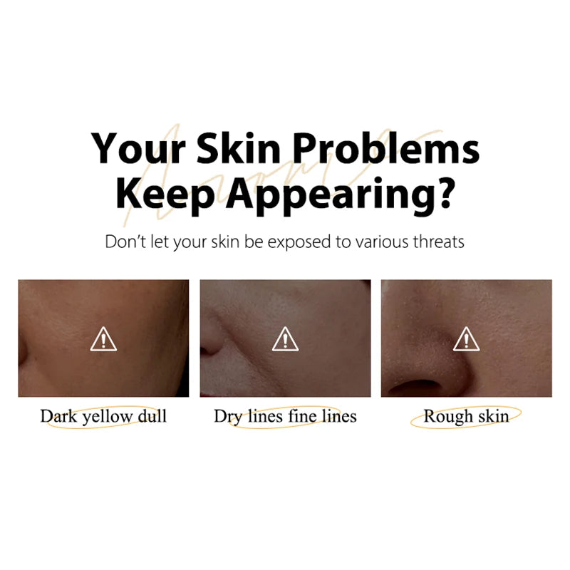 "1Pc MOIKA Skincare Vita C Serum 20% Niacinamide & Vc For Brightening & Dark Spots For People With Dull Loose Skin