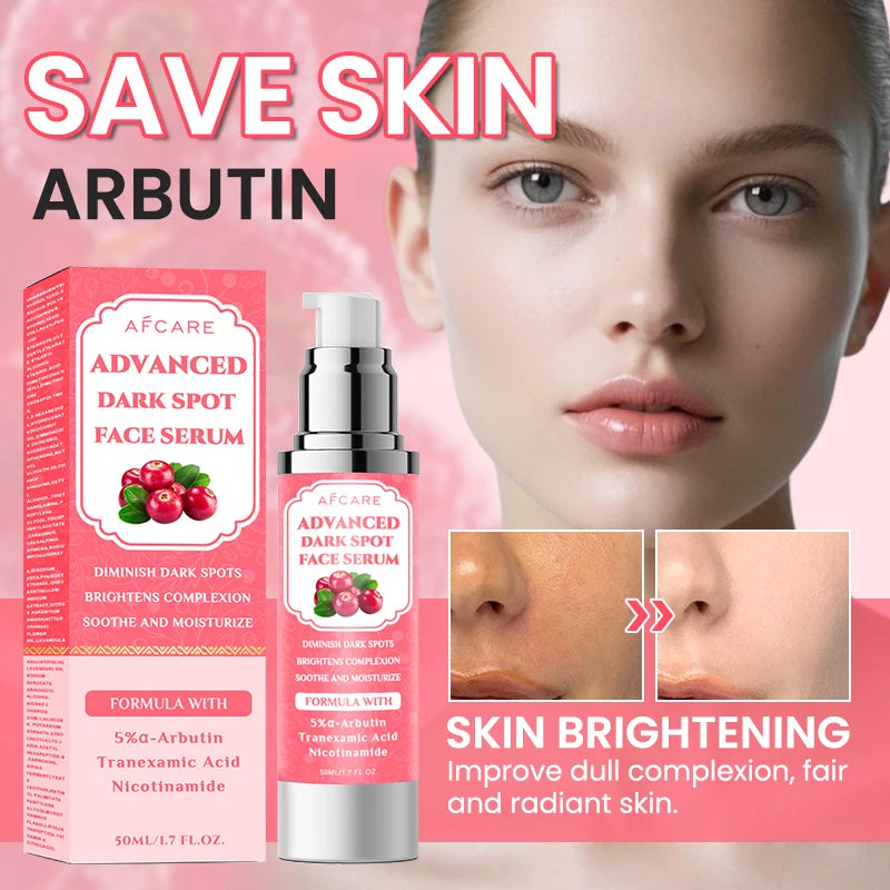 Dark Spots Arbutin Serum Niacinamide Lightens  Brightens Refines Skin Improves Skin Dullness Moisturizes Softens Skin Care