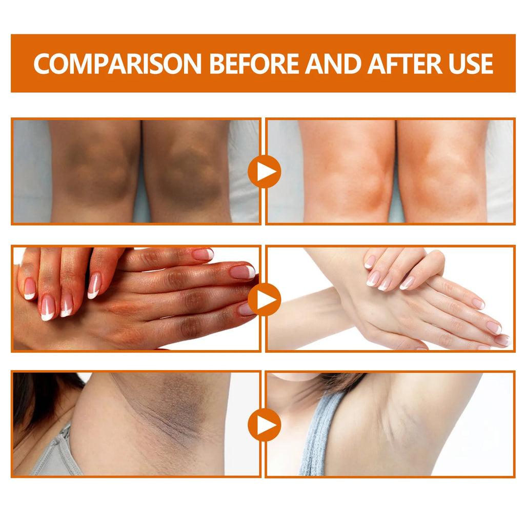 Dark Knuckles Whitening Serum Dark Knees Elbow Lightening Pigmentation Corrector Hand Knuckle Glow Intense Stains Remover Serum