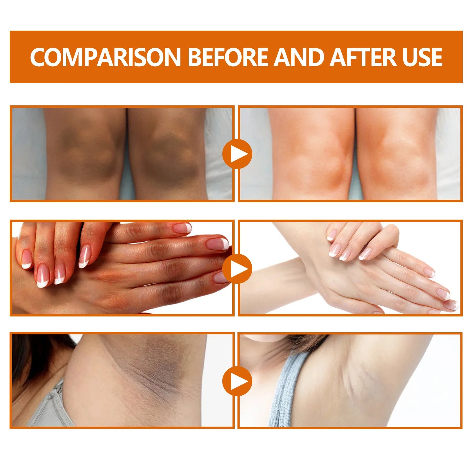 Dark Knuckles Whitening Serum Dark Knees Elbow Lightening Pigmentation Corrector Hand Knuckle Glow Intense Stains Remover Serum