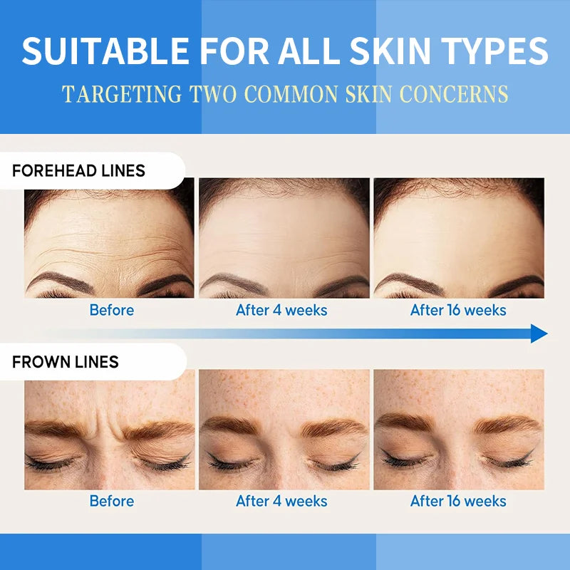 12Pcs Collagen Forehead Skin Care Patches Smoothing Fine Frown Lines Wrinkles Treatment High Quality Natural Material