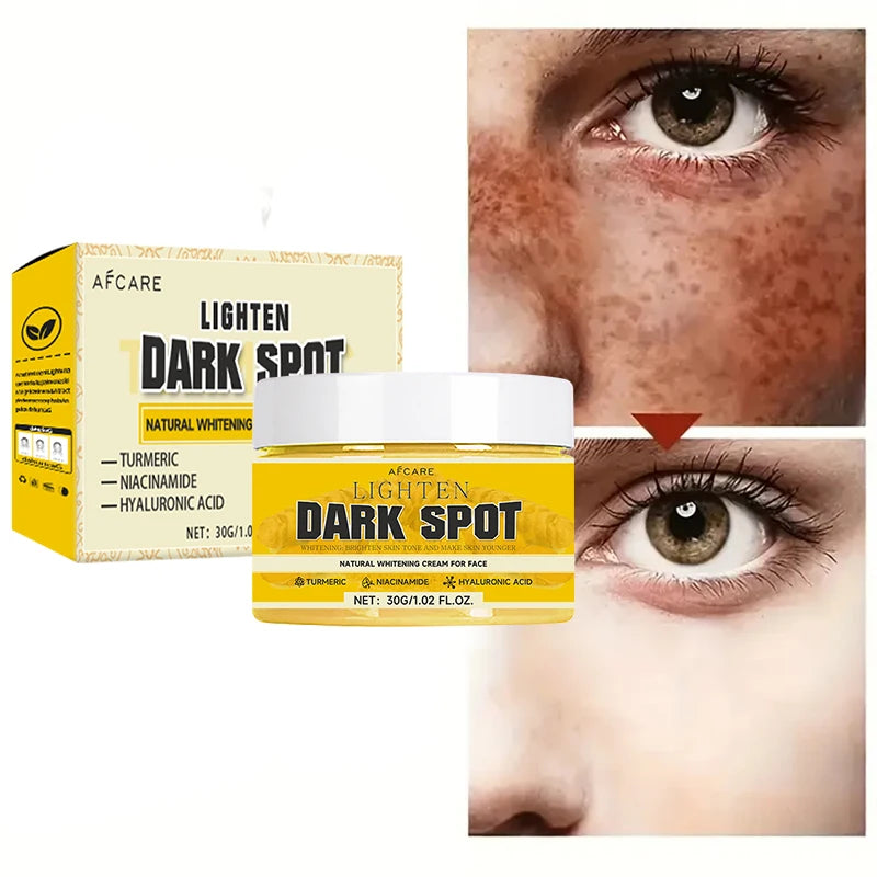 Turmeric for Face Cream Dark Spots Removal Whitening Facial Cream Lightening Improve Dullness Skin Care Products Beauty Health
