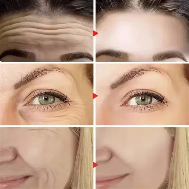 مجموعة فيتا إيه ريتينال شوت الأصلية لشد البشرة، كريم للعينين 15 مل، سيروم للوجه 30 مل، مجموعة العناية بالبشرة الكورية الجديدة