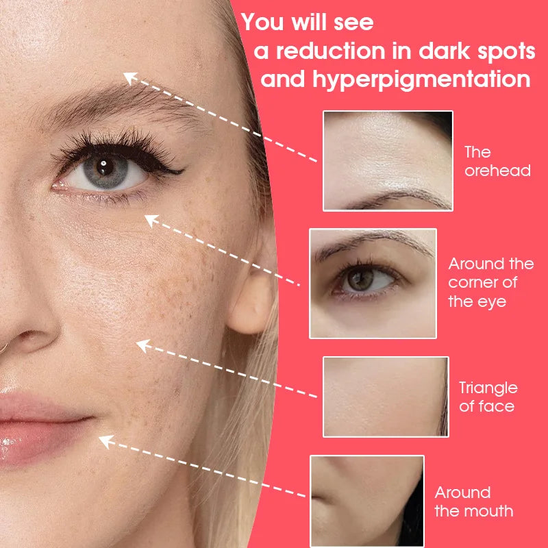 Dark Spots Arbutin Serum Niacinamide Lightens  Brightens Refines Skin Improves Skin Dullness Moisturizes Softens Skin Care