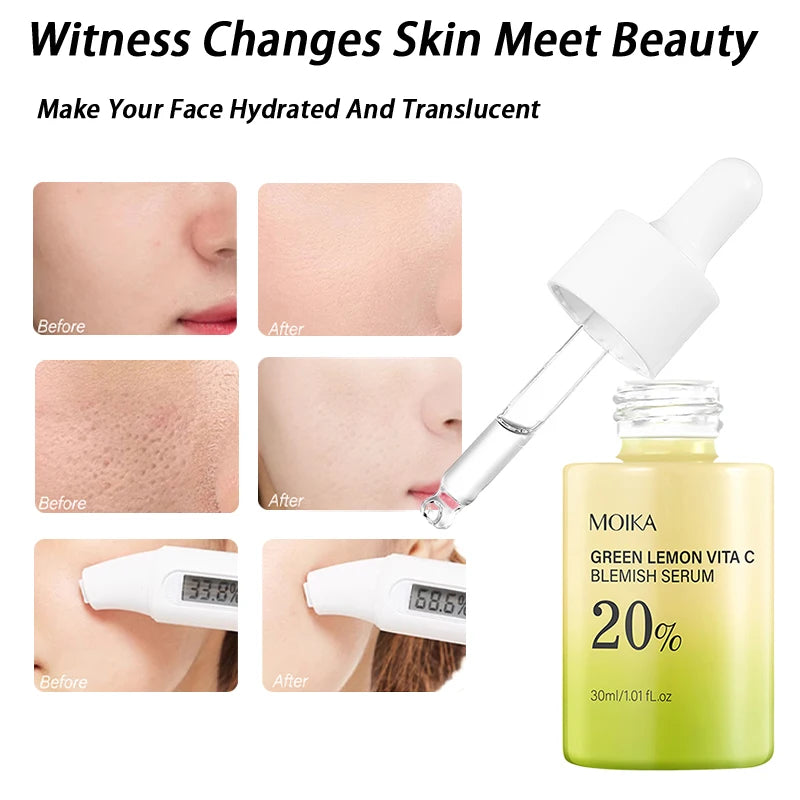 "1Pc MOIKA Skincare Vita C Serum 20% Niacinamide & Vc For Brightening & Dark Spots For People With Dull Loose Skin