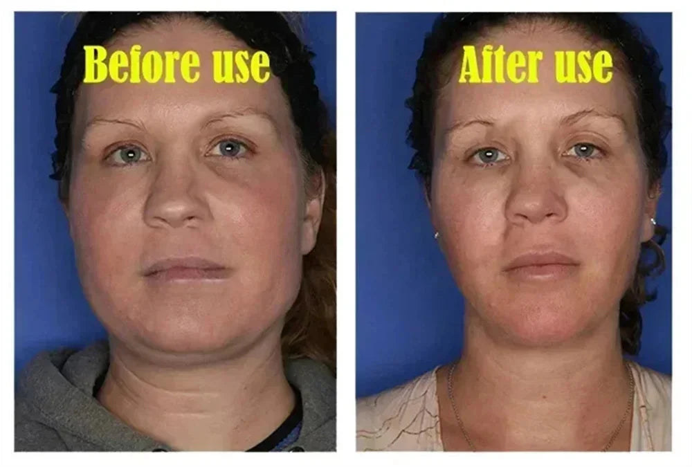 V-Shape Face Slimming Cream Remove Double Chins Firming Lifting Up V Cheek Fat Burning Anti-aging Shaping Massage Care Products