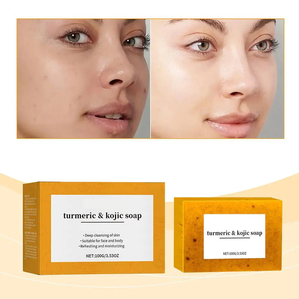 100g Turmeric Hand Made Soap Lemon Kojic Acid Shower and Facial Soap Body Cleansers Brightening Face Soap Tender Skin Care