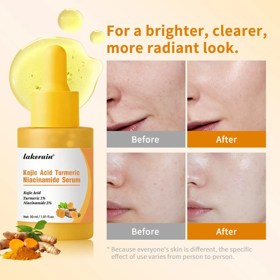 Kojic Acid Turmeric Serum Niacinamide Glow Capsules Brightening Hydration Balancing Skin Barrier Soothing Troubled Facial Care