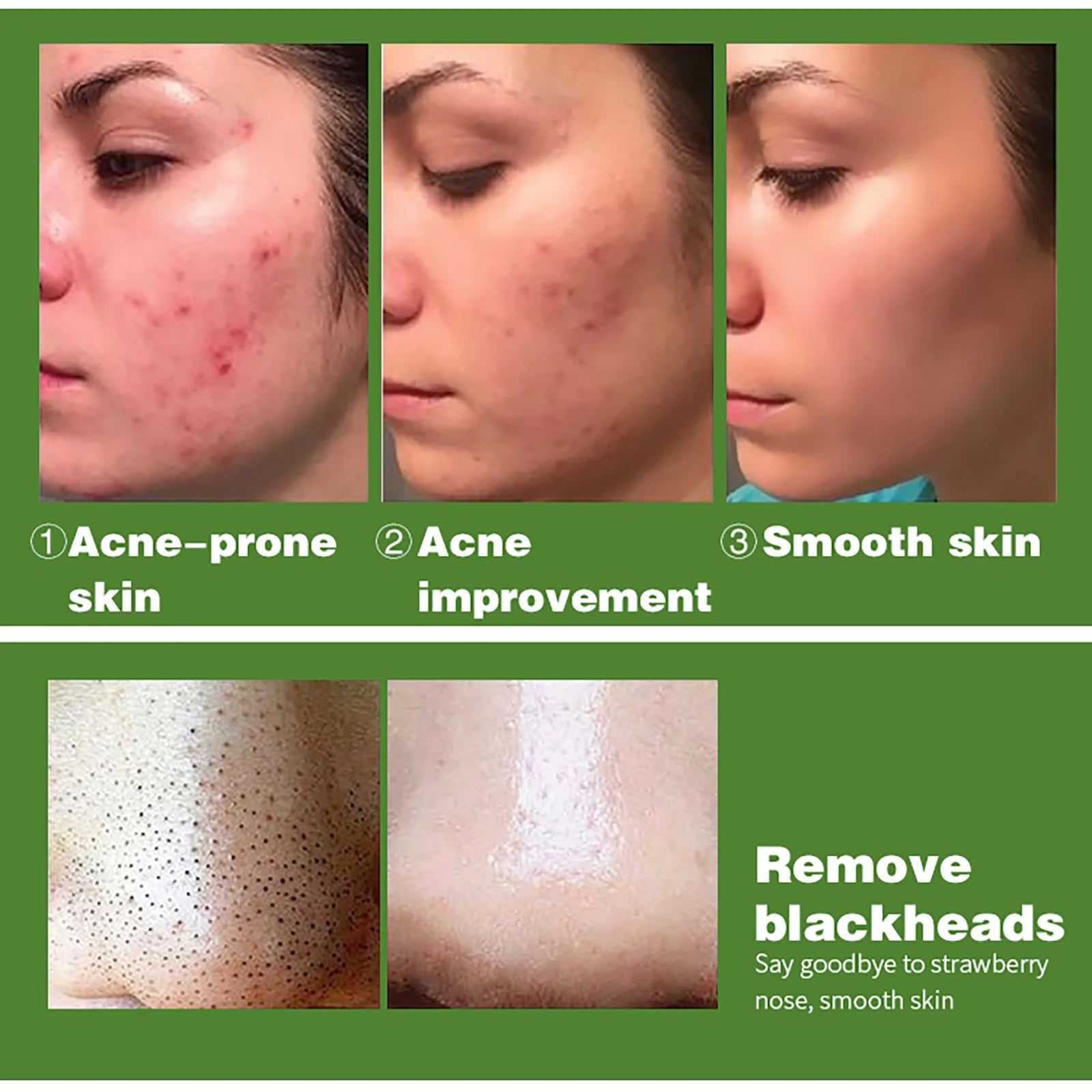 AILKE Organic Turmeric Whitening Skin Care Set, with Vitamin C, Clean Skin, Reduce Acne, Hydrating and Firming for Women