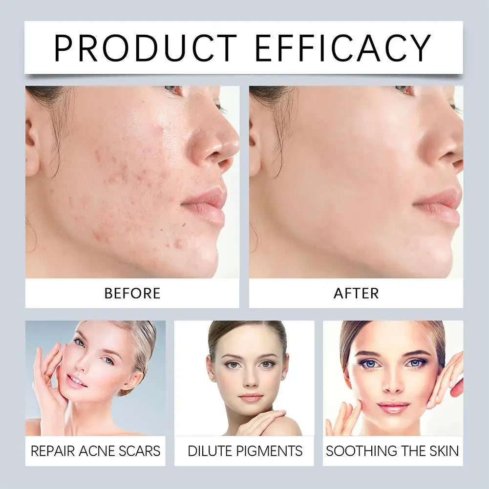 New 30ml Skin Texture | Pore Refining Resurfacing, with Facial Serum Niacinamide Retinol and Brightening Non-Comedogenic S6Z8
