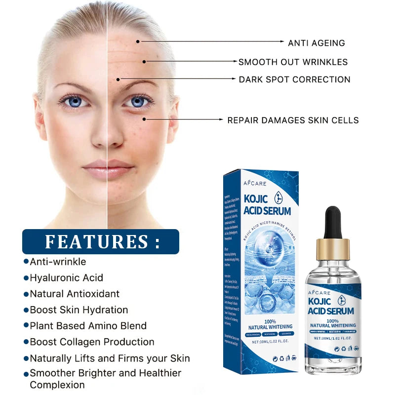 Kojic Acid Fades Freckle Dark Spot Face Serum with Niacinamide and Vitamin E for Quick Brightening Nourishing Skin Care Product