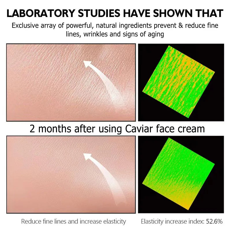 Summer Collagen Caviar Anti-Wrinkle Cream Efficient Fade Fine Lines Anti Aging Whitening Beauty Products Korean Cosmetics