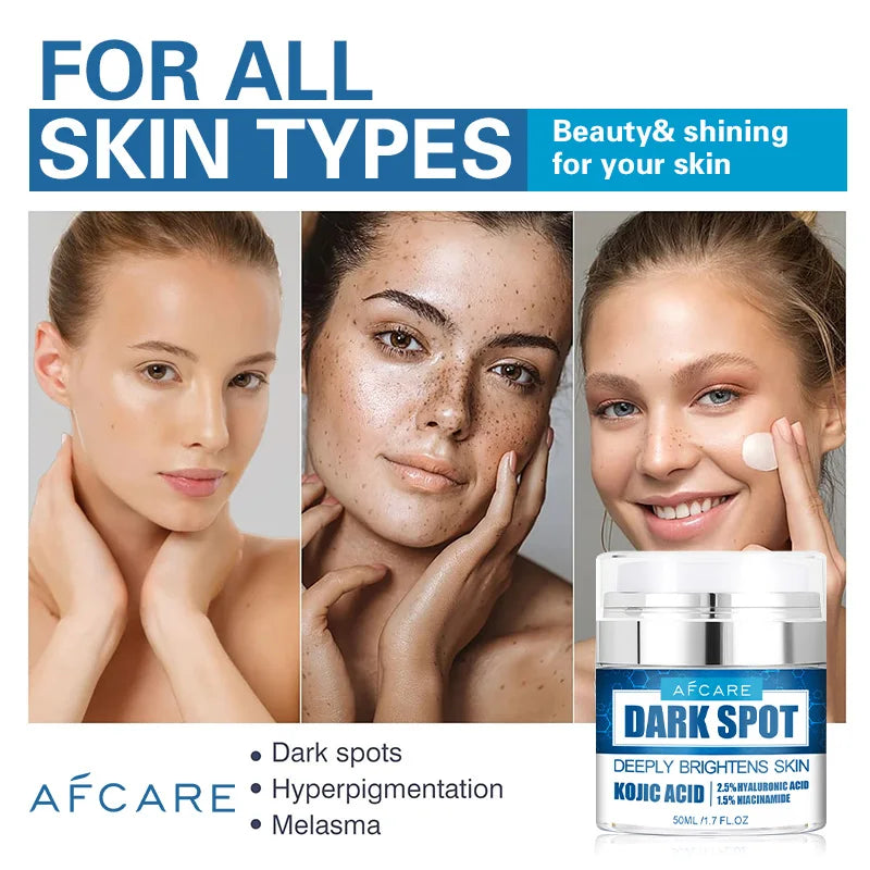 Dark Spots Remove Kojic Acid Cream Face Nicotinamide Effective Whiten Anti-pigmentation Improve Dullness Skin Care Cream 50ML