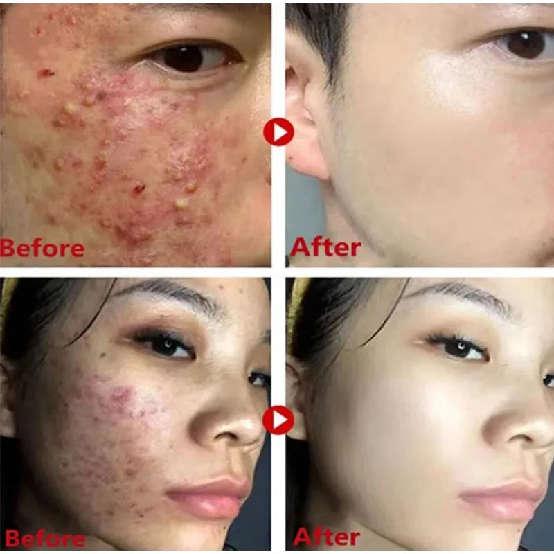 Green Tea Remove Blackhead Solid Mask Dispel Acne Blemish Cleansing Stick Mask Shrink Pores Tighten Whitening Skin Care Products