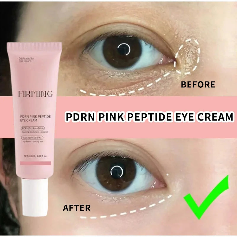 Korean PDRN Pink Peptide Eye Cream,Eye Contour Skin Firming Lifting Hydrating Brightening Care,Fade Fine Lines and Dark Circles