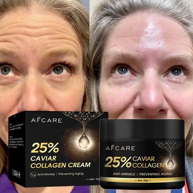 Summer Collagen Caviar Anti-Wrinkle Cream Efficient Fade Fine Lines Anti Aging Whitening Beauty Products Korean Cosmetics