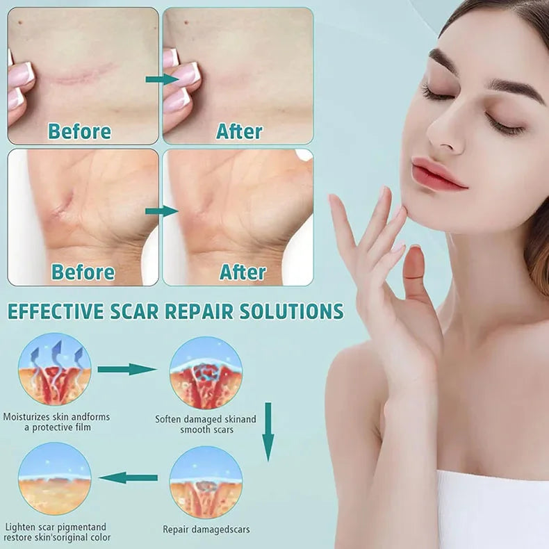 Fast Scar Removal Cream Treatment Stretch Marks Burn Surgical Scar Acne Spots Repair Gel Whitening Moisturizing Smooth Skin Care