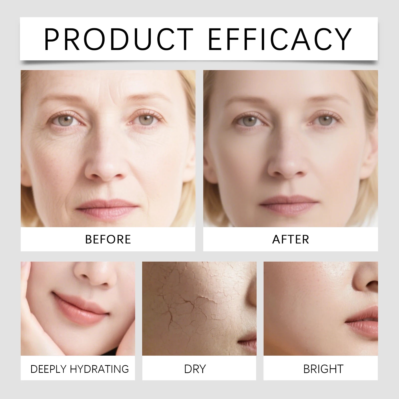 Facial serum Microneedle Roller Set 0025mm Niacinamide serum Moisturizing  Winter skincare Barrier Protection Moisturizer 40ml