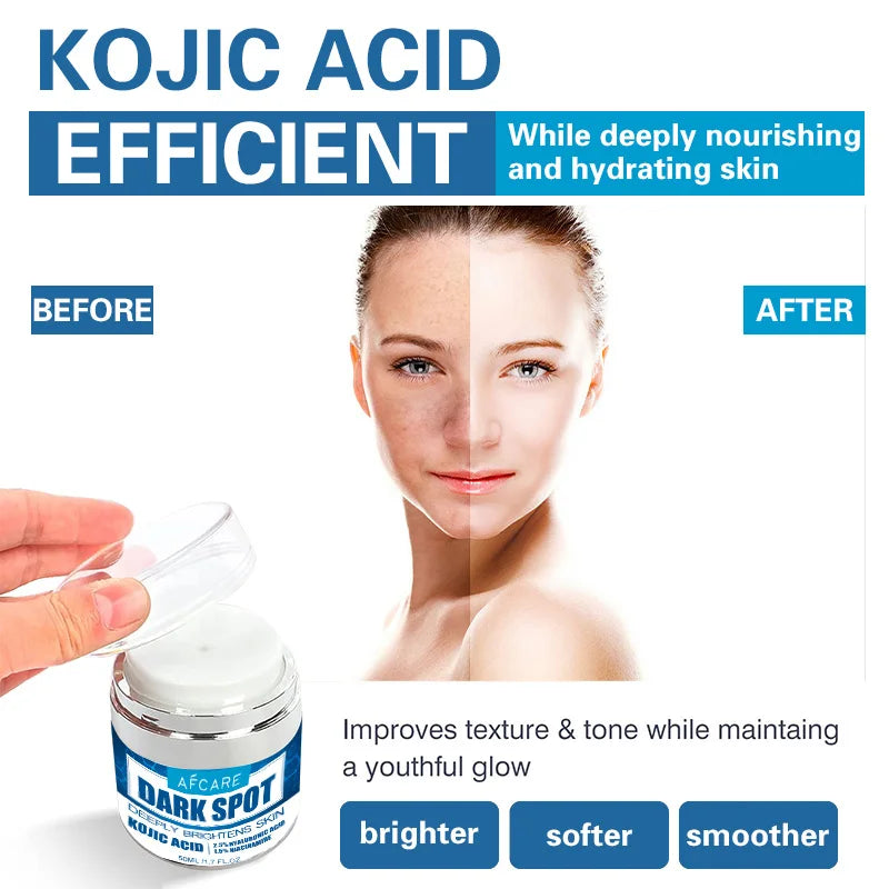 Dark Spots Remove Kojic Acid Cream Face Nicotinamide Effective Whiten Anti-pigmentation Improve Dullness Skin Care Cream 50ML