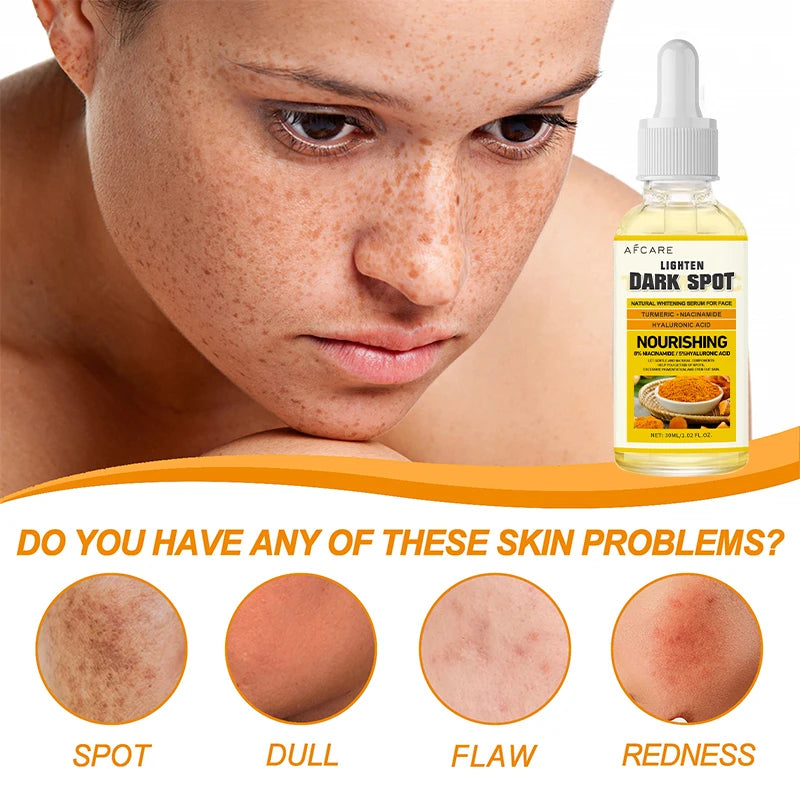 Dark Spot Facial Serum Turmeric Essence Remove Dark Spots Melasma Niacinamide Brighten Lighten Melanin Skin Care Products