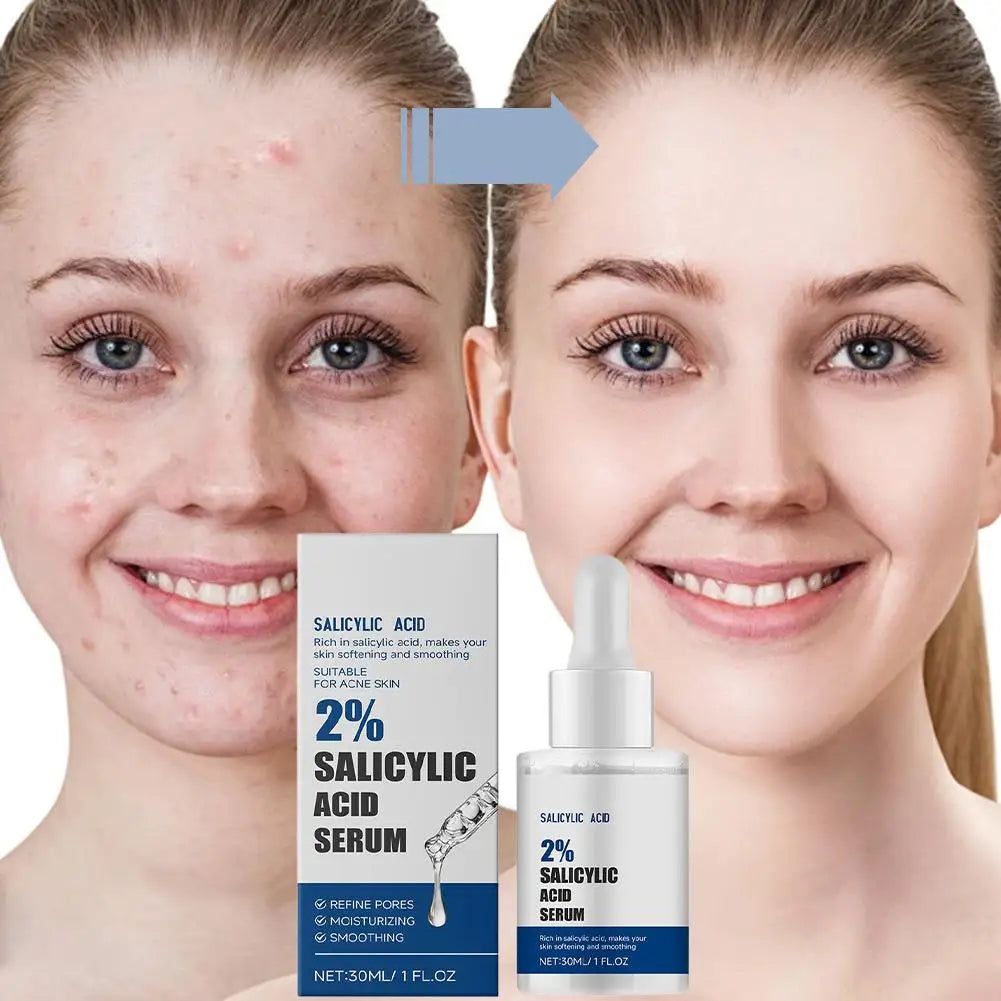 New 30ml Skin Texture | Pore Refining Resurfacing, with Facial Serum Niacinamide Retinol and Brightening Non-Comedogenic S6Z8