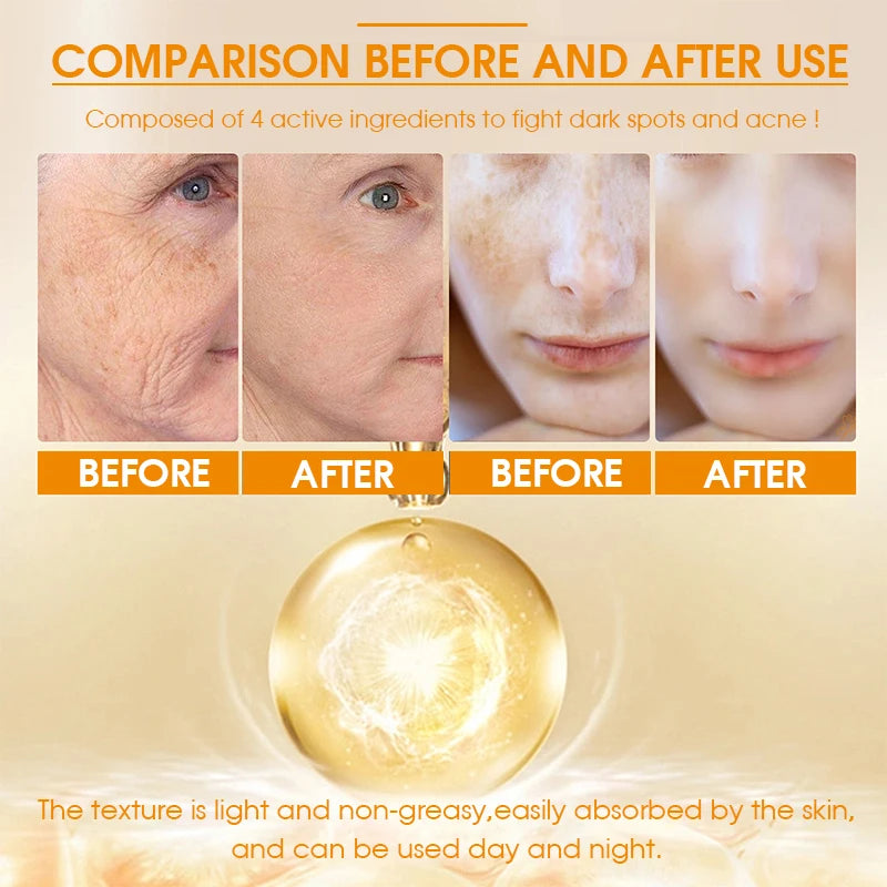 Turmeric Serum Moisturizing Facial Skin Essence  Niacinamide Hyaluronic Acid Daily Care