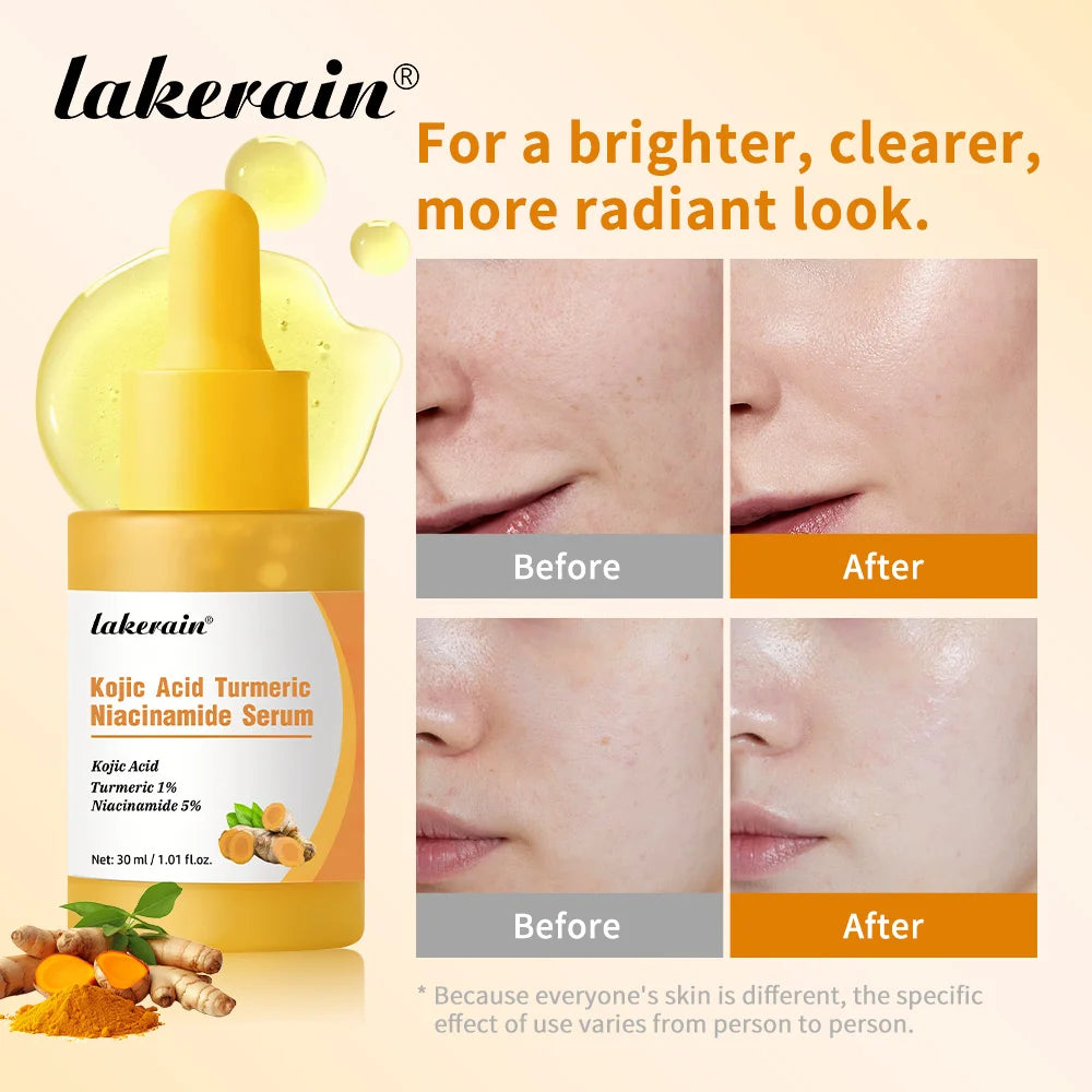 Kojic Acid Turmeric Serum Niacinamide Glow Capsules Brightening Hydration Balancing Skin Barrier Soothing Troubled Facial Care