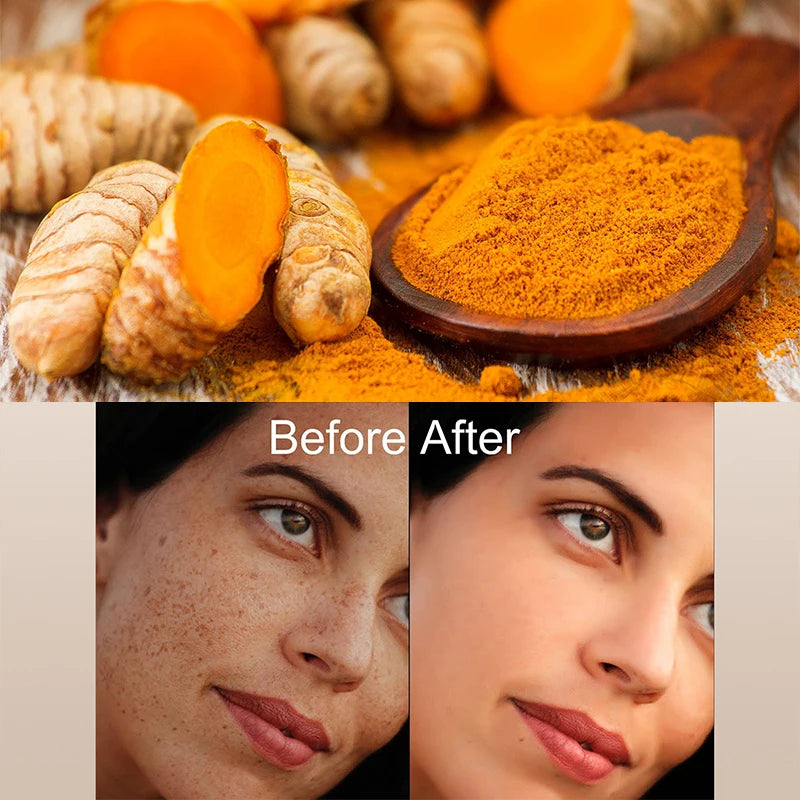 Dark Spot Facial Serum Turmeric Essence Remove Dark Spots Melasma Niacinamide Brighten Lighten Melanin Skin Care Products