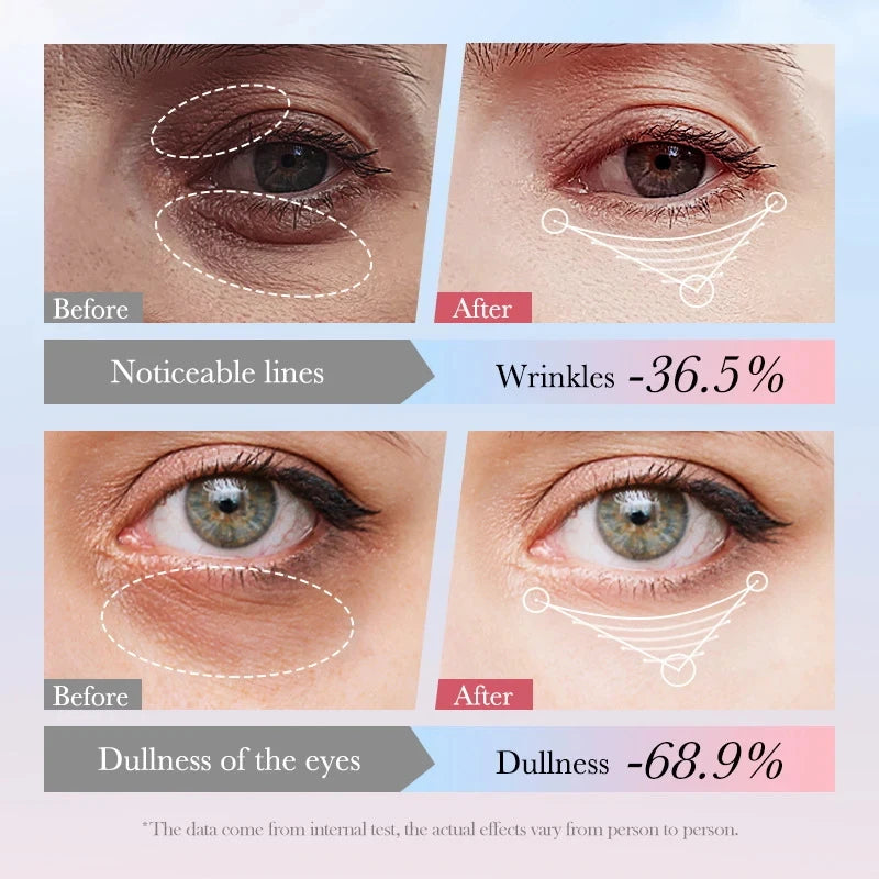 Eye Bag Removal Cream Collagen Anti-Wrinkle Fade Fine Lines Firming Skin Anti Dark Circle Puffiness Brighten Eye Care