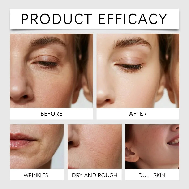 2026 Radiant Flawless Skin Micro Infusion Serum Kit - At Home Facial System Beauty Tool Skin Care for Face | 0.25MM Needle