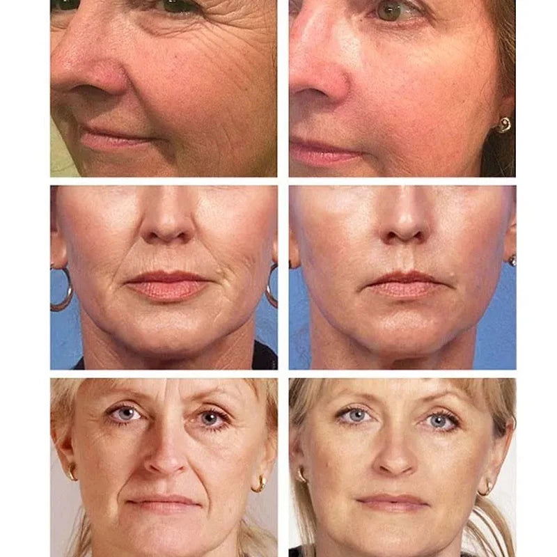 Summer Collagen Caviar Anti-Wrinkle Cream Efficient Fade Fine Lines Anti Aging Whitening Beauty Products Korean Cosmetics