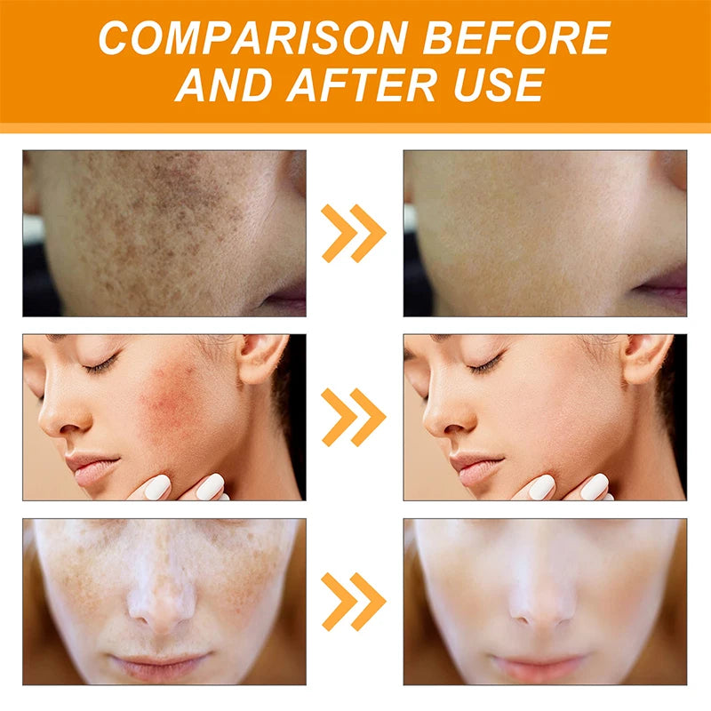Dark Spot Facial Serum Turmeric Essence Remove Dark Spots Melasma Niacinamide Brighten Lighten Melanin Skin Care Products