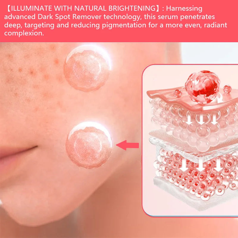 Dark Spots Arbutin Serum Niacinamide Lightens  Brightens Refines Skin Improves Skin Dullness Moisturizes Softens Skin Care