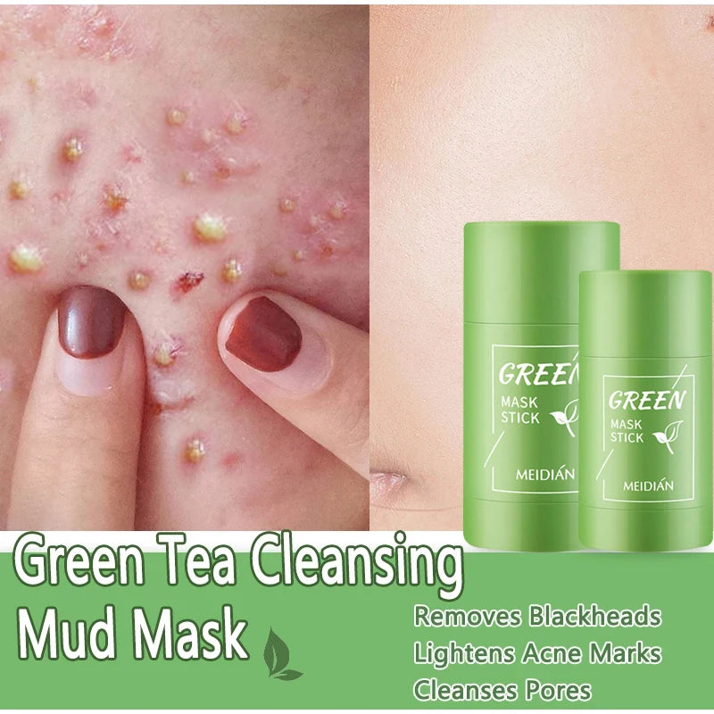 Green Tea Remove Blackhead Solid Mask Dispel Acne Blemish Cleansing Stick Mask Shrink Pores Tighten Whitening Skin Care Products