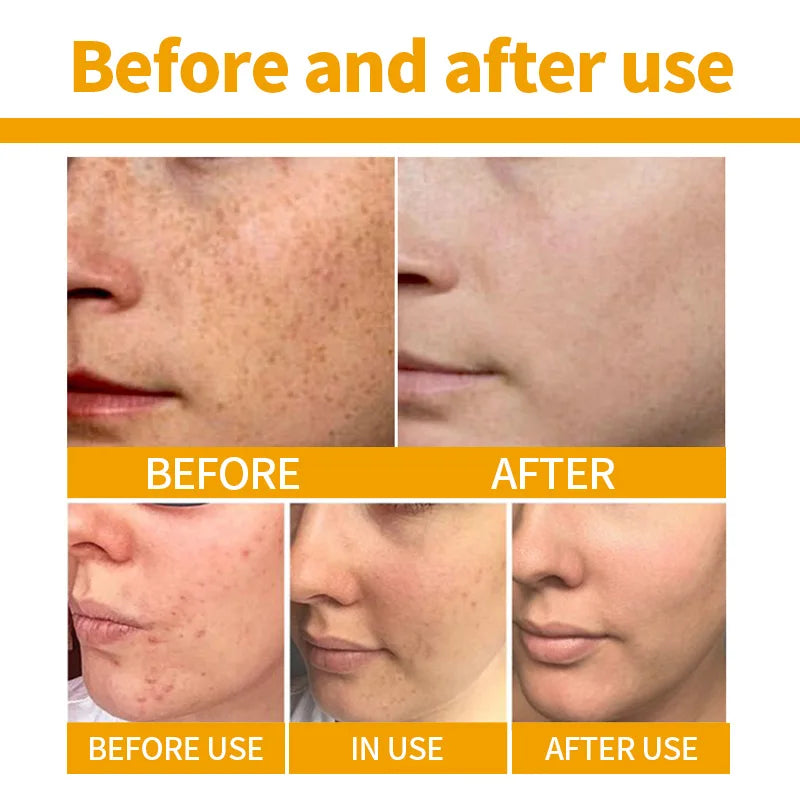 Turmeric for Face Cream Dark Spots Removal Whitening Facial Cream Lightening Improve Dullness Skin Care Products Beauty Health