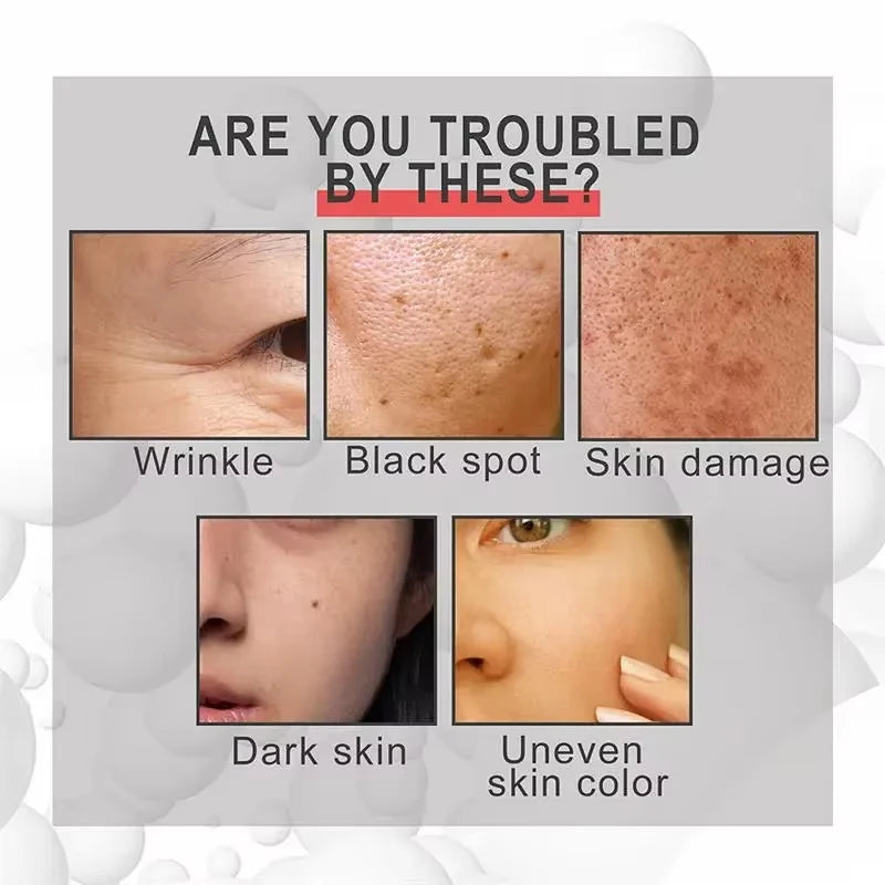 يقدم هذا السيروم المكثف تركيبة متطورة لاستهداف البقع الداكنة والنمش والميلانين، مما يساعد على توحيد لون البشرة وتقليل التصبغات بفعالية.